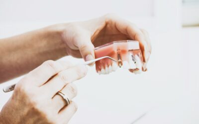 La dentizione geriatrica